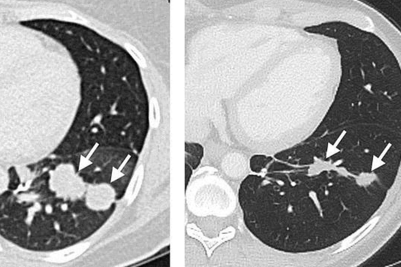 Seguridad y Transparencia con ONCOCIT RED CANCER para Vencer el Cáncer